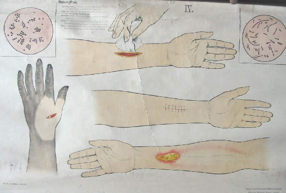 Schulwandbild von Dr. F. A. Düms