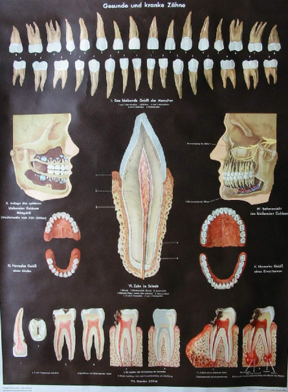 Schulwandbild des Deutschen Gesundheits-Museums Köln